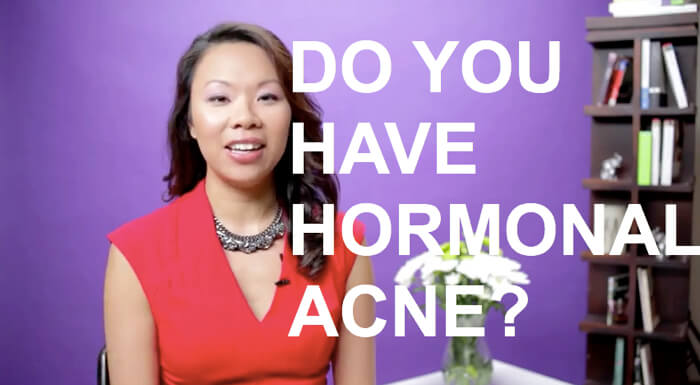 Hormonal Acne – How Do You know?